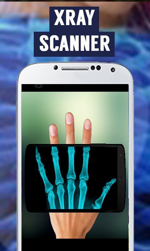 Xray Camera Scanner