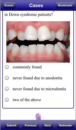 NBDE II Stanford Review Course