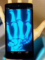 x ray wallpaper free