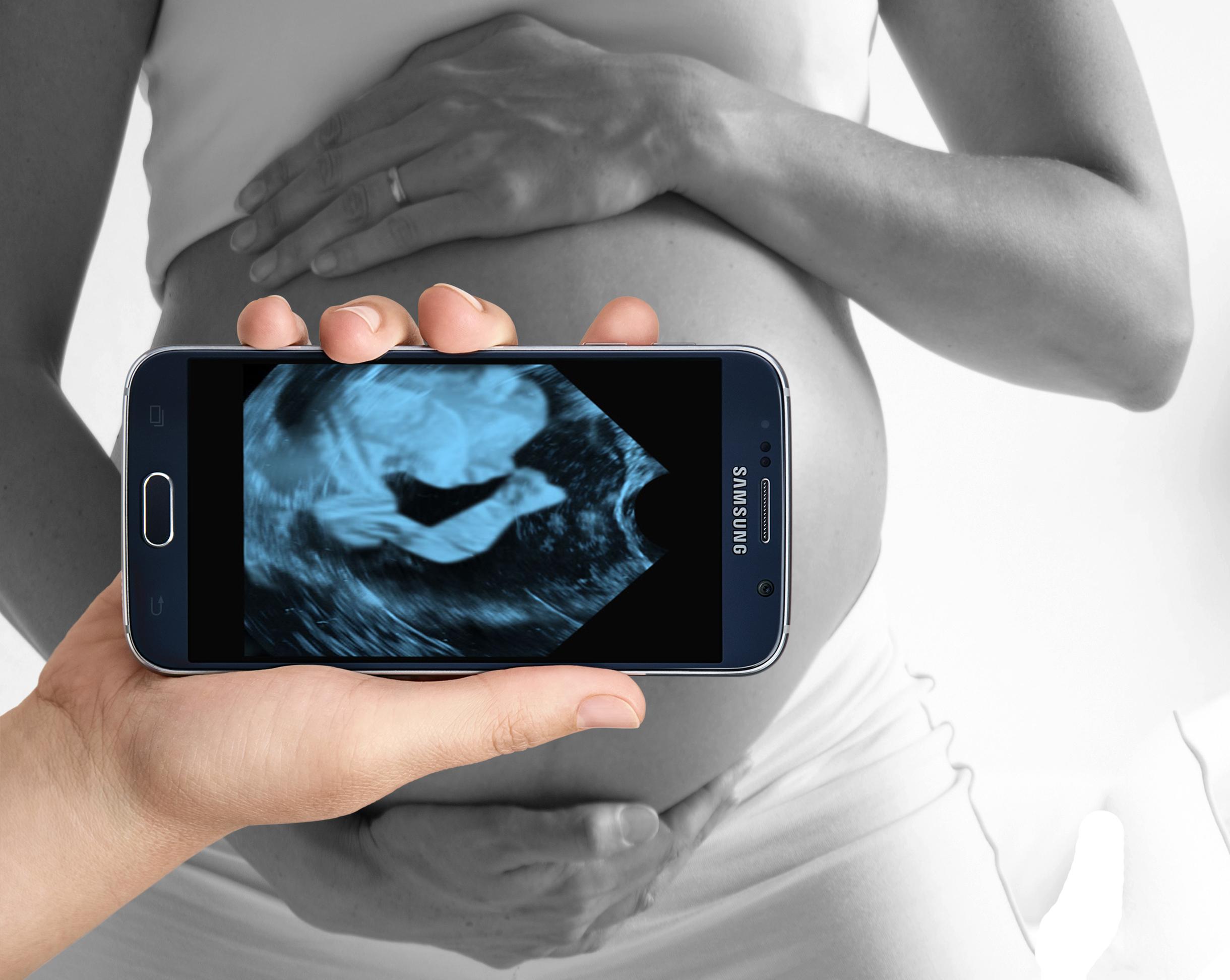 Ultrasound Pregnancy (Prank)